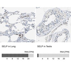 P-Selectin/CD62P Antibody, Novus Biologicals 0.1mL; Unlabeled:Antibodies,